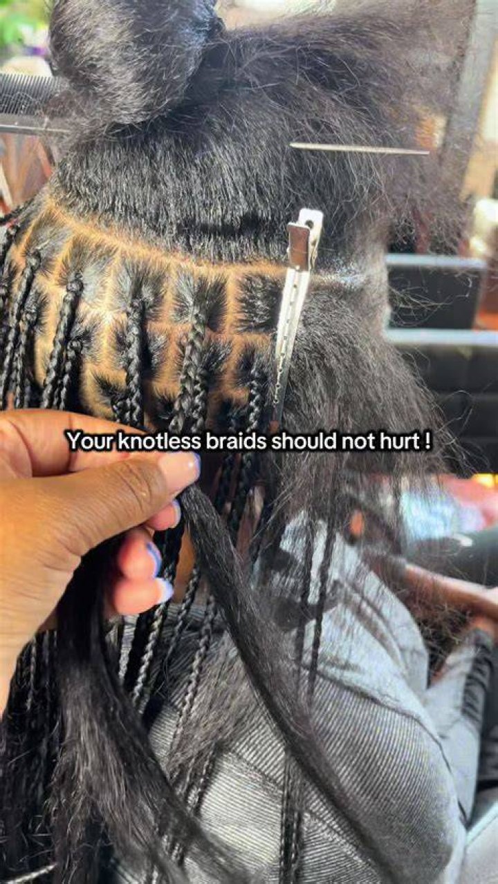 Are braids supposed to hurt?
