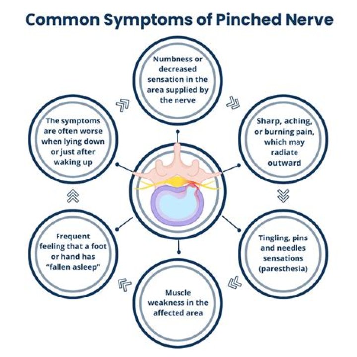 Can a pinched nerve cause earache?