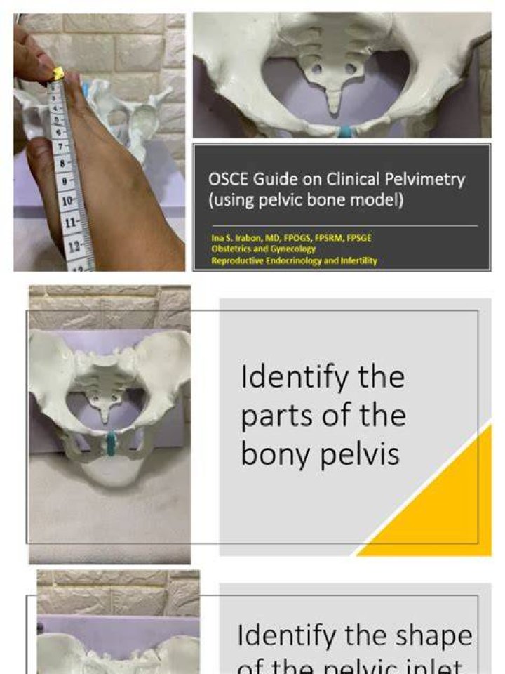 How to do clinical pelvimetry?