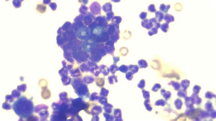 Is canine blastomycosis contagious?