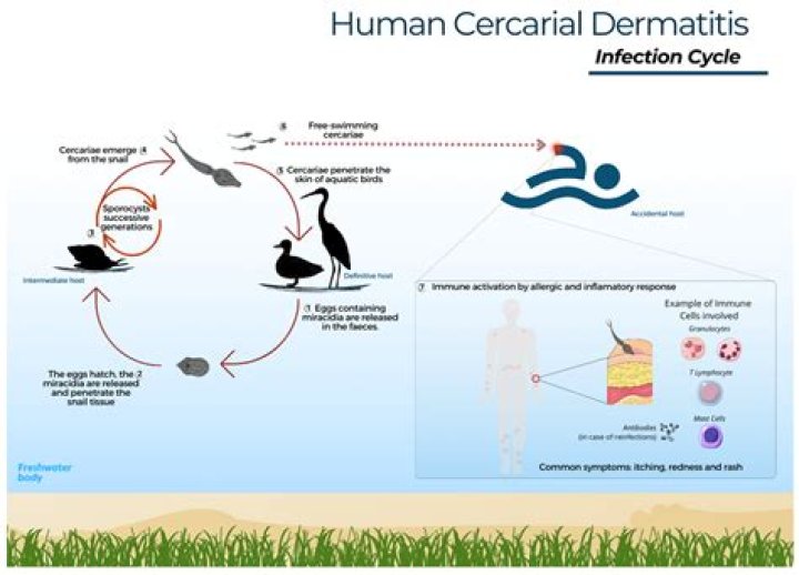 Is cercarial dermatitis dangerous?