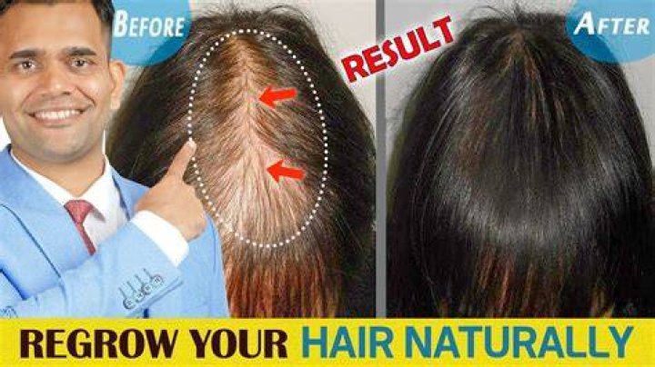 Is fallen hair regrow?