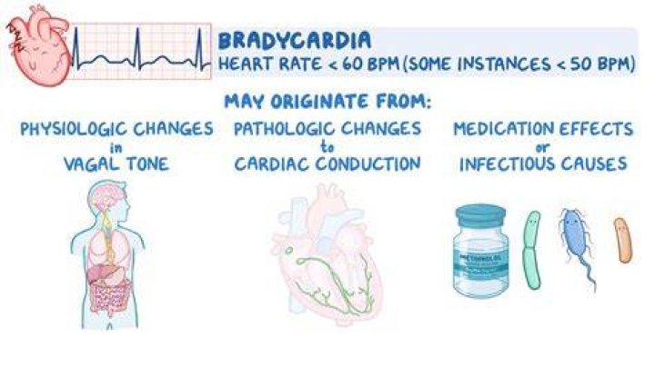 Should bradycardia be treated?