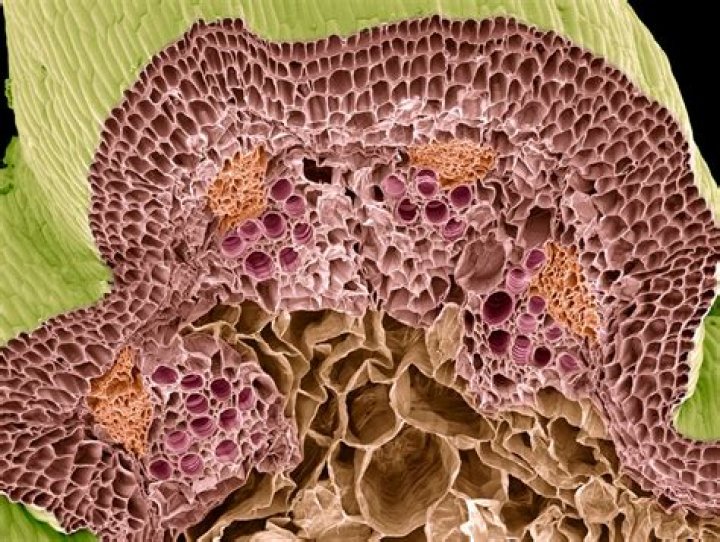 What are tyloses in botany?