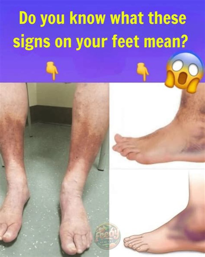 What does light on your feet mean?