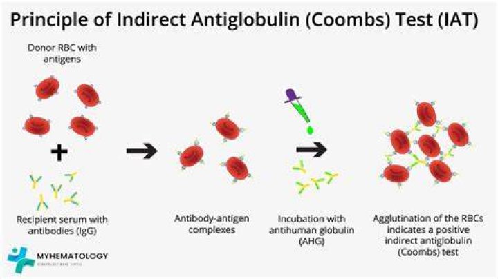 What is a positive indirect coombs test?