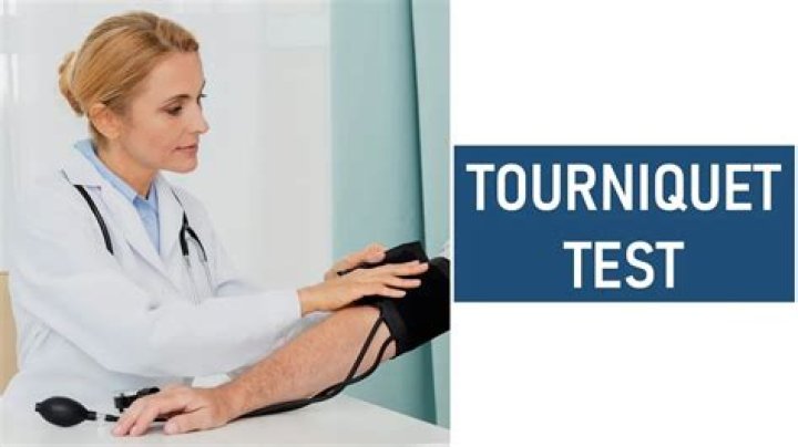 What is tourniquet test?
