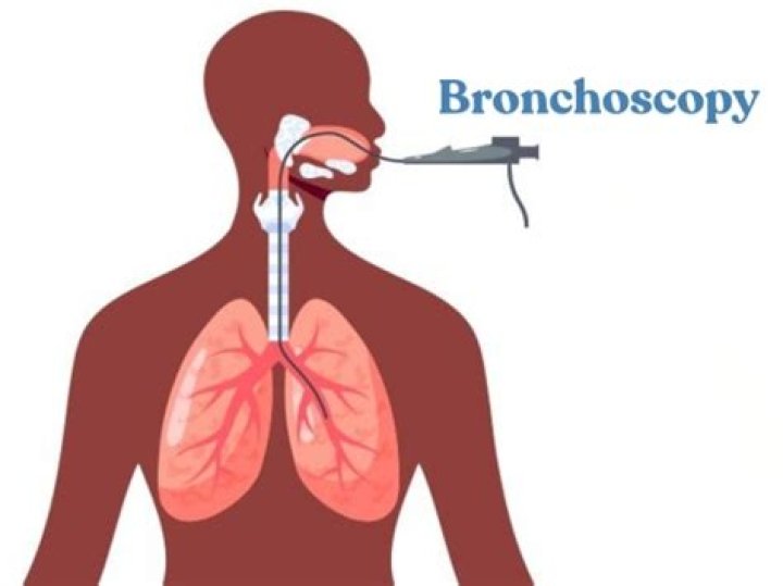When a bronchoscopy is performed under fluoroscopic guidance?