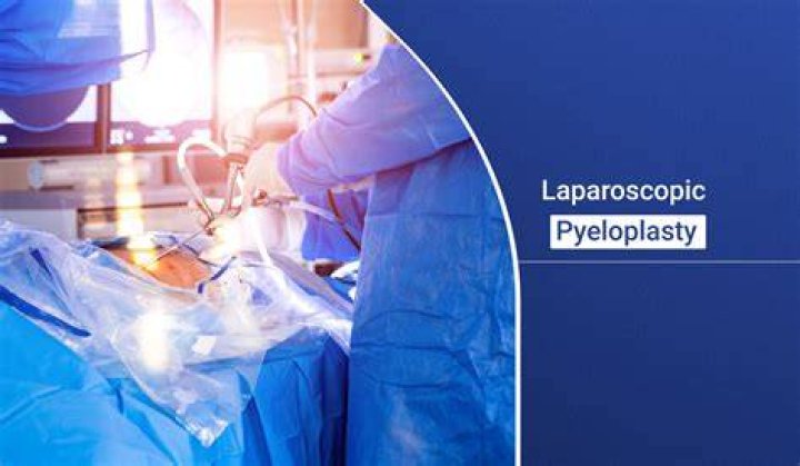 Why is a pyeloplasty done?