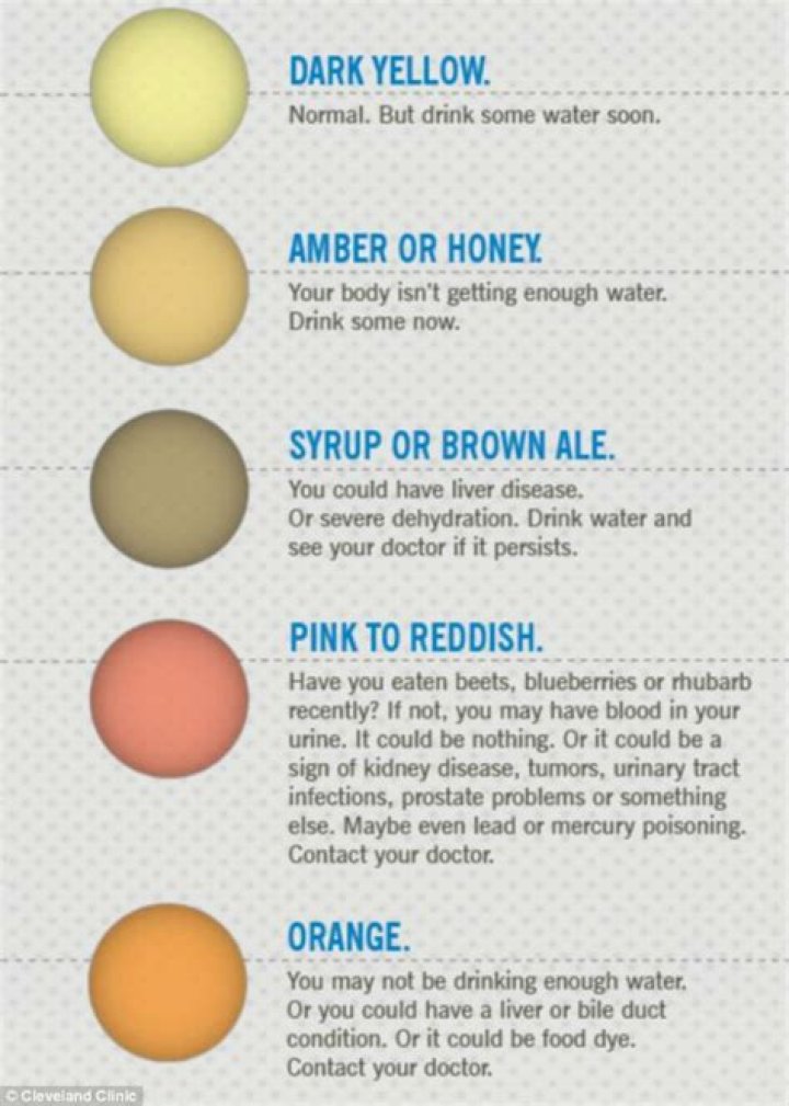 Why is my pee orangish brown?