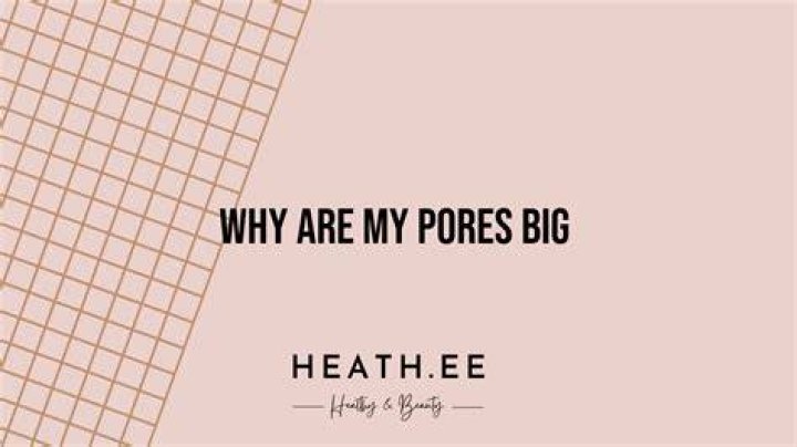 Why my pores are big?